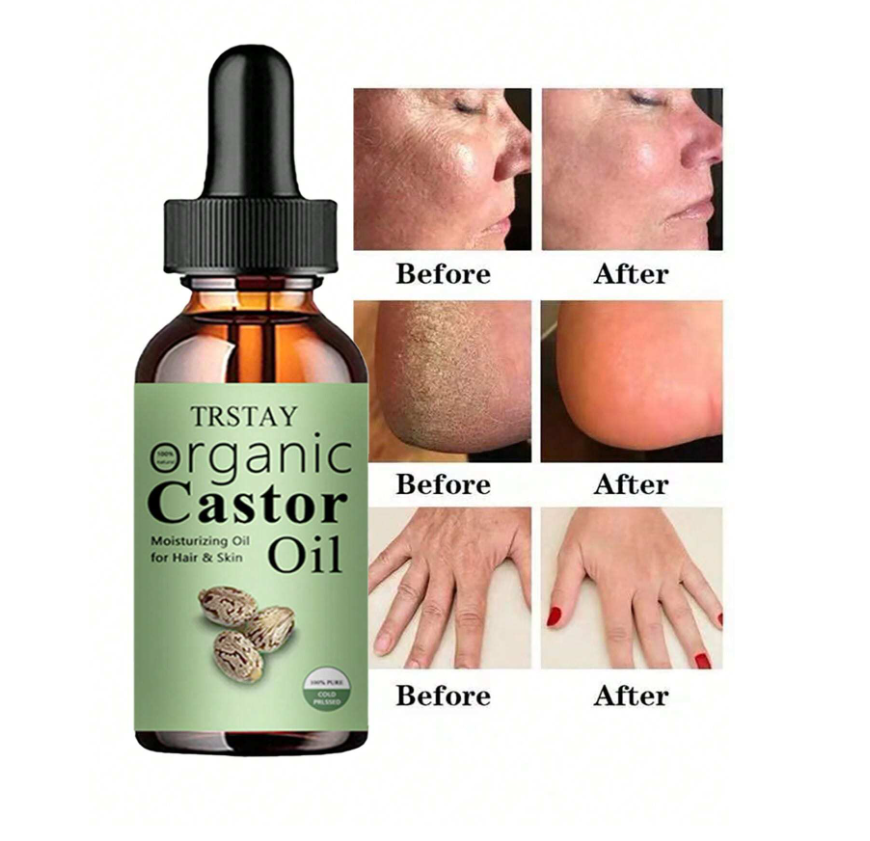 Castor Oil Hair Treatment 15ml